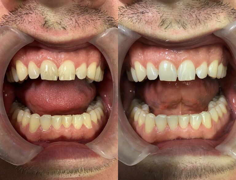 Dental Hygienist Benfleet, Hadleigh Benfleet Dental Centre