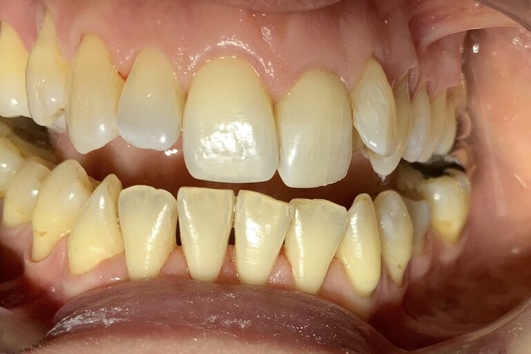 Dental Hygienist Benfleet, Hadleigh Benfleet Dental Centre