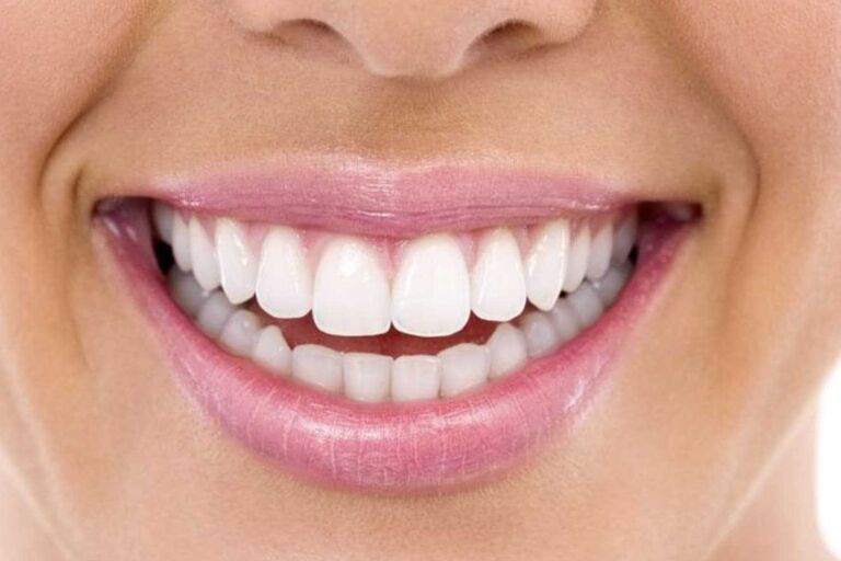 Enlighten teeth whitening essex