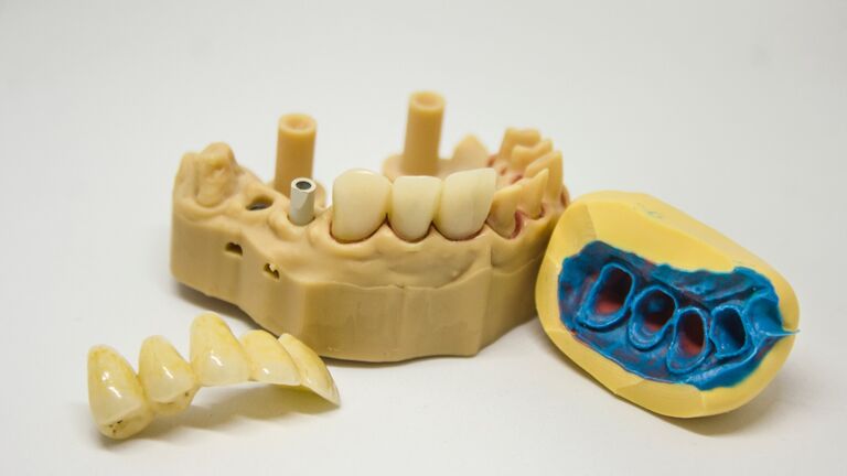 Preventing and Treating a 'Dead Tooth' | Benfleet Dental Centre
