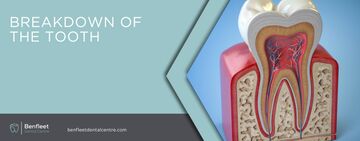 Breakdown of the tooth