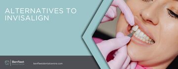 Alternatives to Invisalign