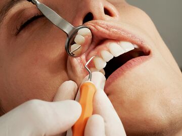 How Much Does a Dental Check-Up Cost