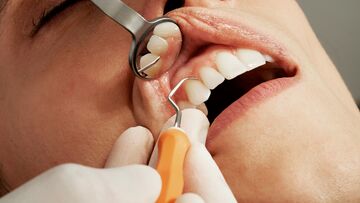 How Much Does a Dental Check-Up Cost