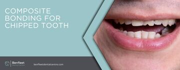Composite bonding for chipped tooth